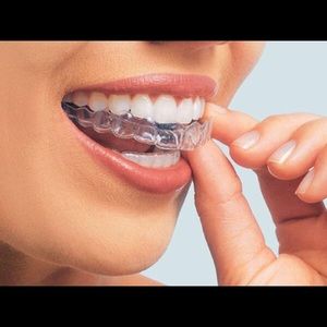 Custom Orthodontic Dental Retainers